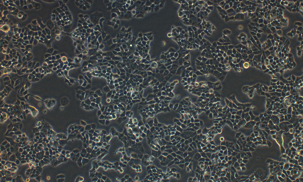 人乳腺导管癌细胞T47D (STR鉴定正确)