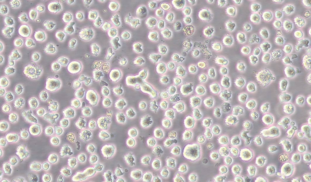 人骨髓瘤细胞U266 (STR鉴定正确)