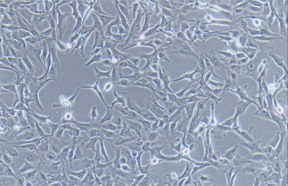 人肺腺癌细胞Calu-1(STR鉴定正确)