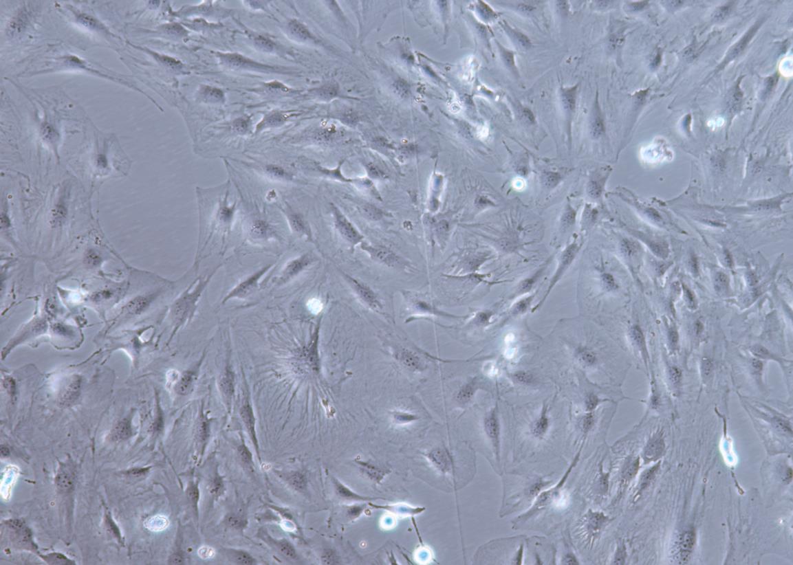 人肝癌细胞SNU-387(STR鉴定正确)