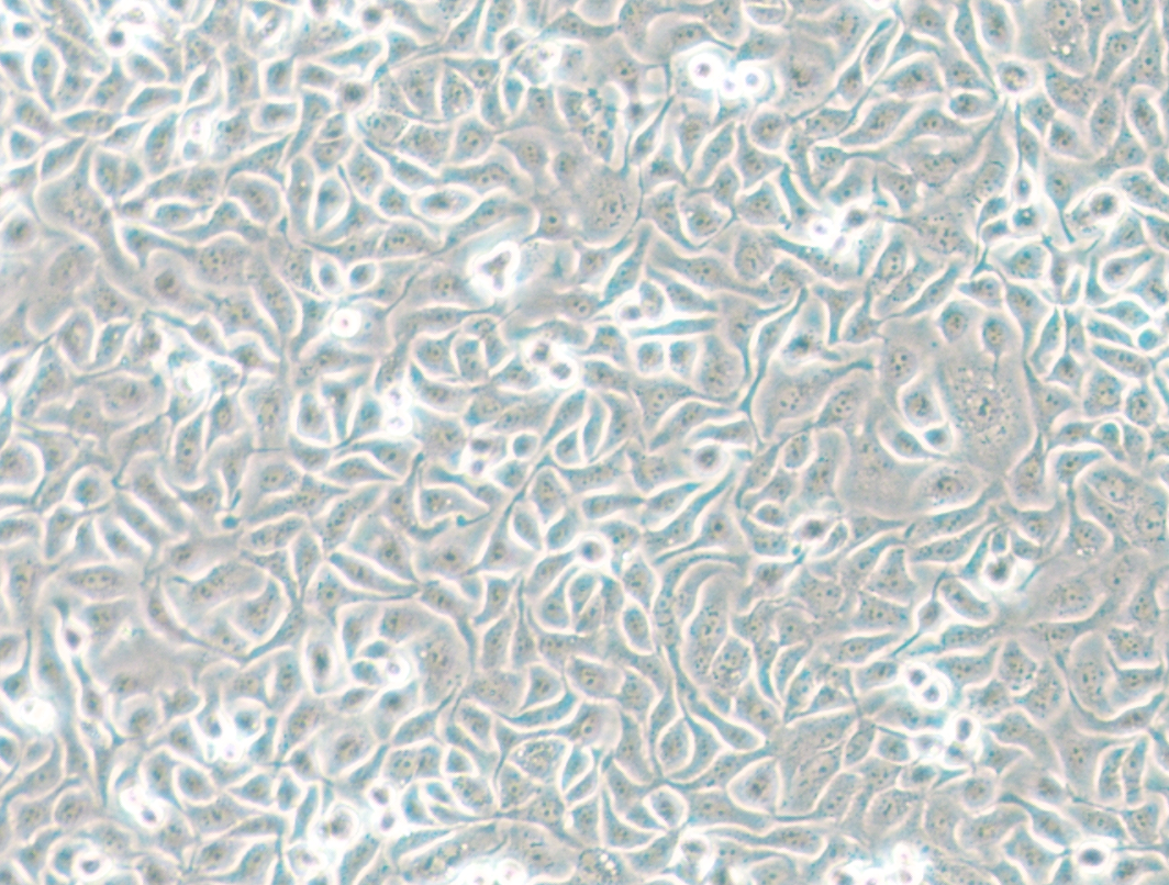 人乳腺癌细胞HCC1806(STR鉴定正确)