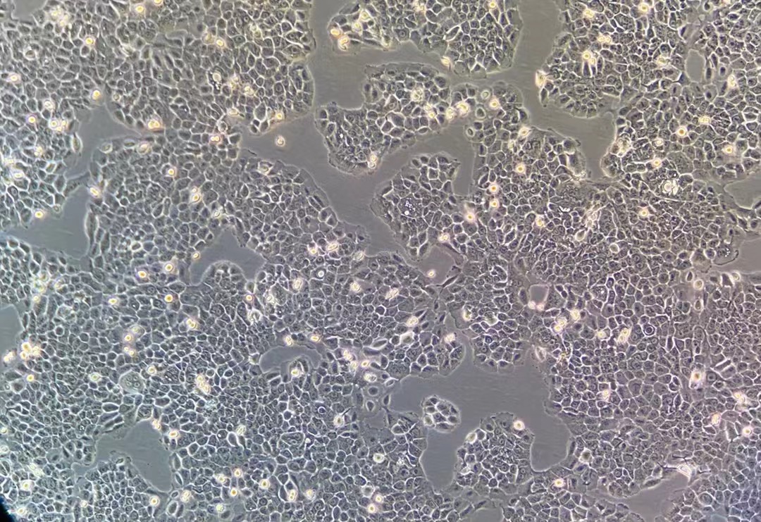 人肺腺癌细胞NCI-H292(STR鉴定正确)