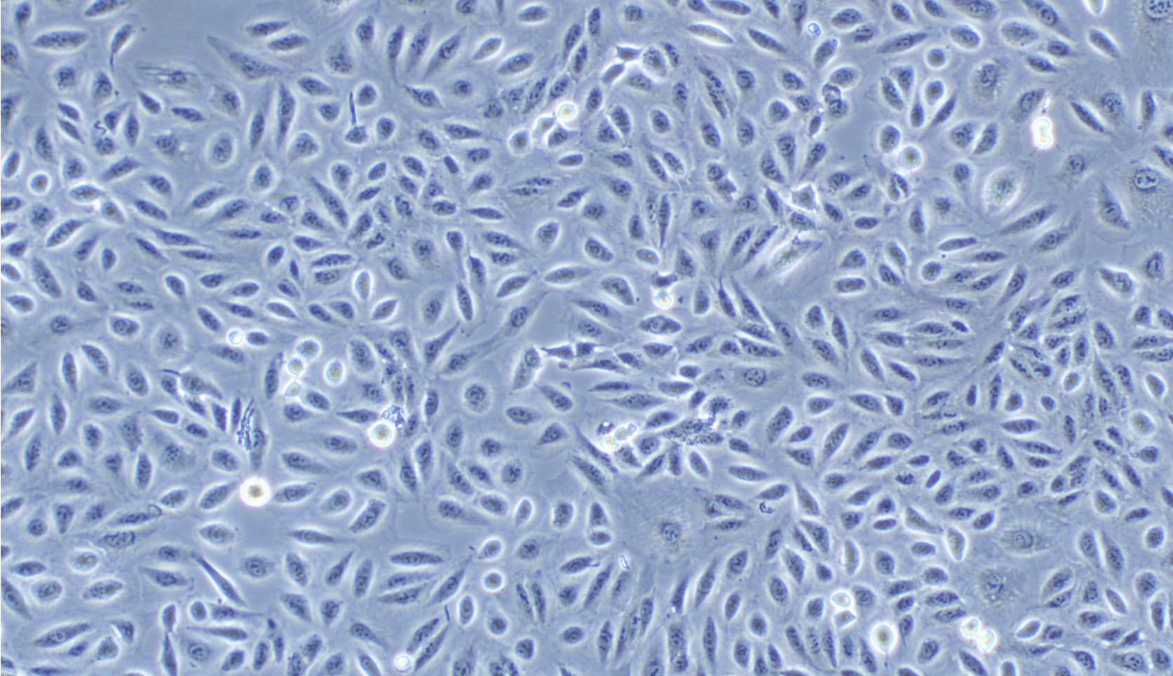 人甲状腺乳头状细胞TPC-1(STR鉴定正确)