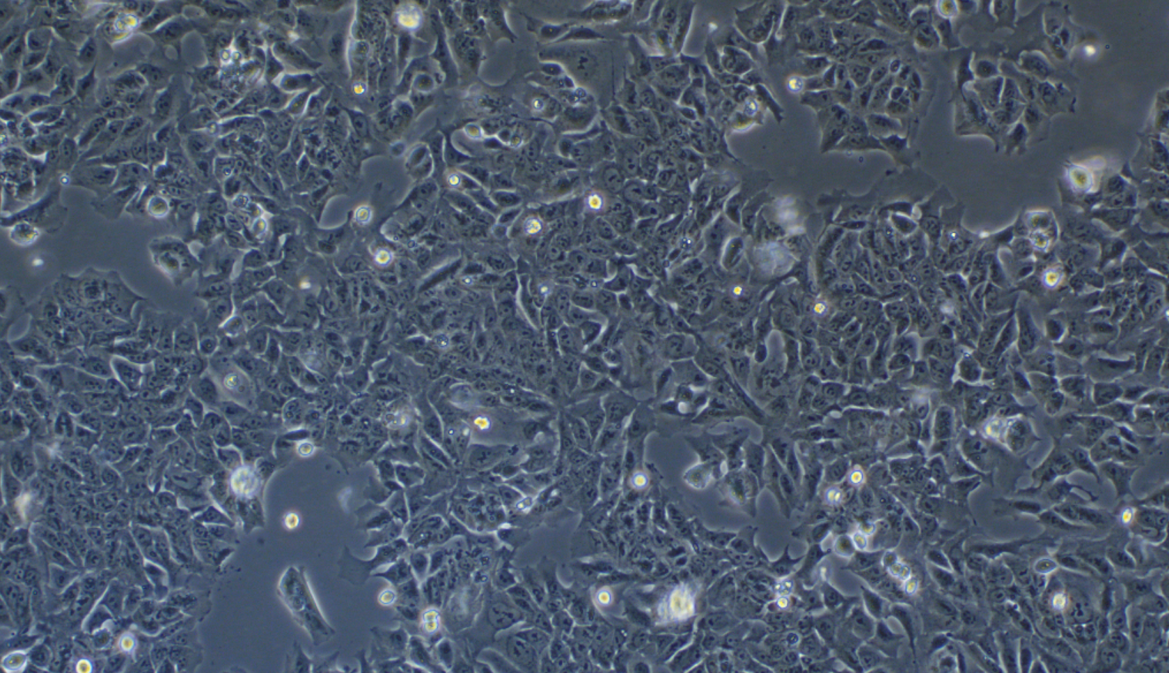 人结直肠腺癌上皮细胞DLD-1(STR鉴定正确)