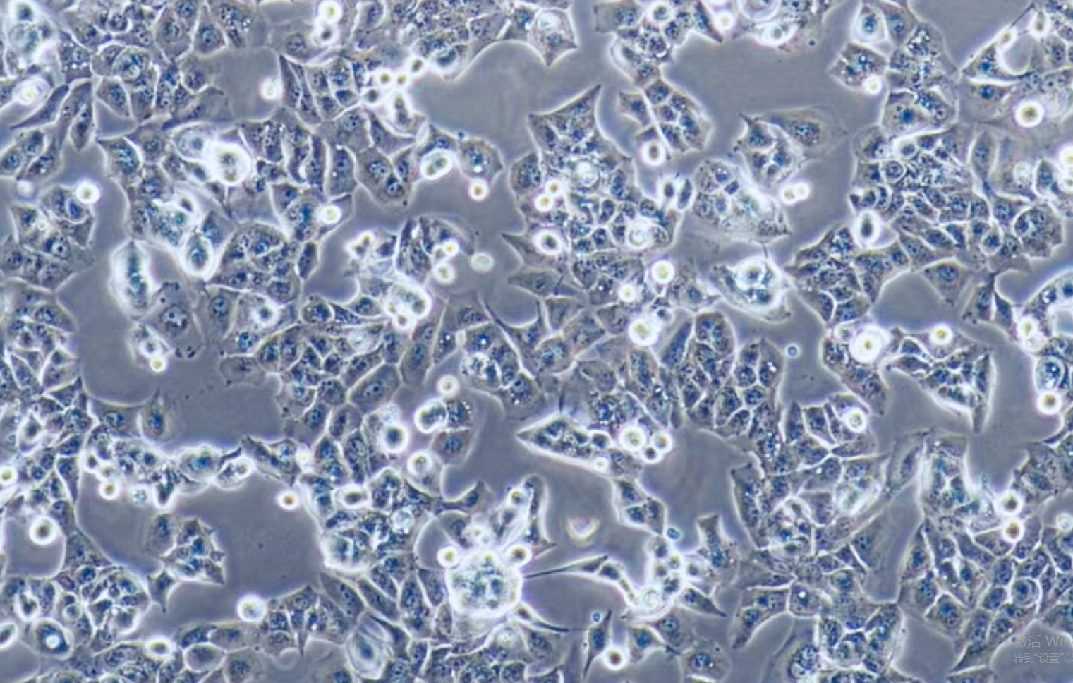 高转移人肝癌细胞MHCC97-H(STR鉴定正确)