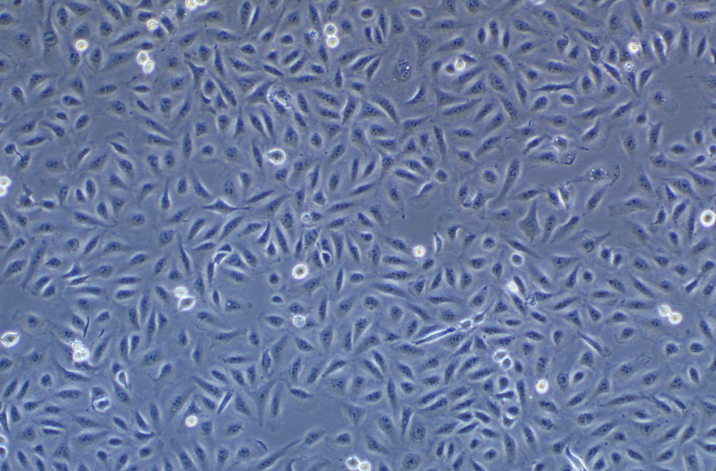 人肺癌细胞带绿色荧光 A549+GFP (STR鉴定正确)