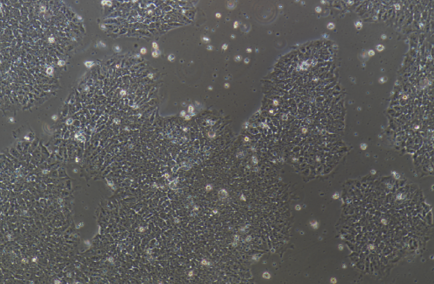 多功能诱导干细胞iPS(STR鉴定正确)