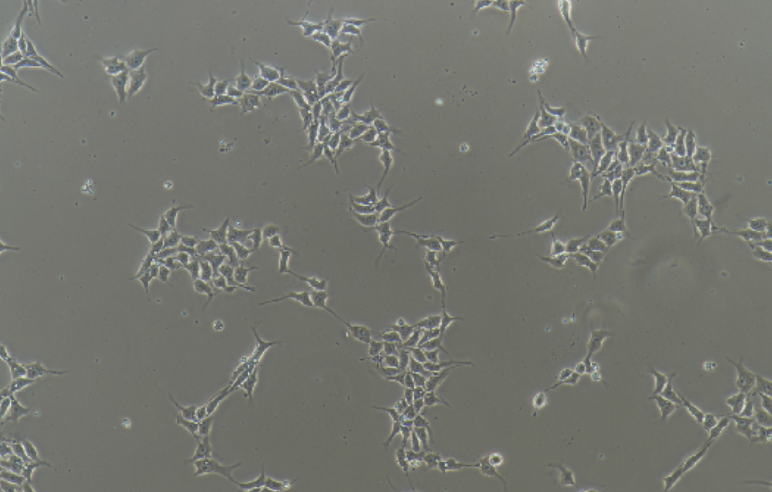 多功能诱导干细胞iPS(STR鉴定正确)