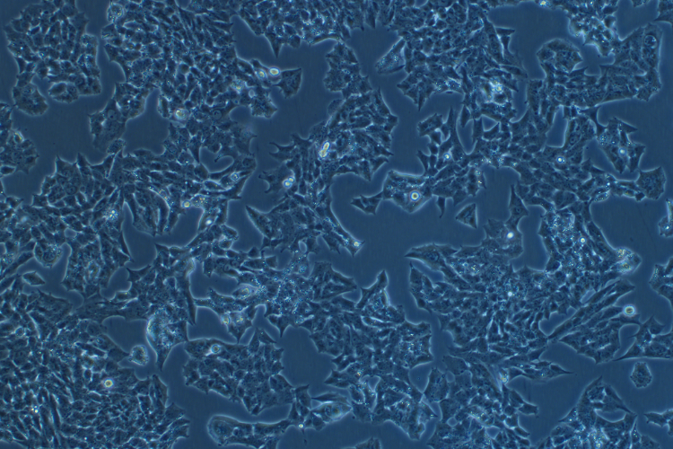 人肾上腺皮质腺癌细胞NCI-H295R(STR鉴定正确)