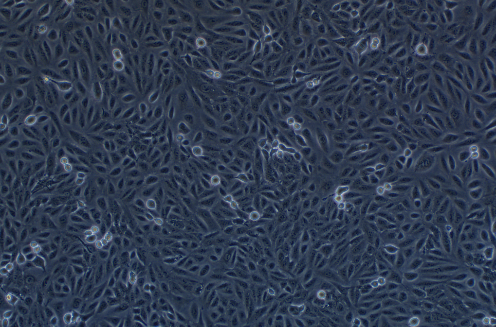 人甲状腺乳头状细胞TPC-1(STR鉴定正确)