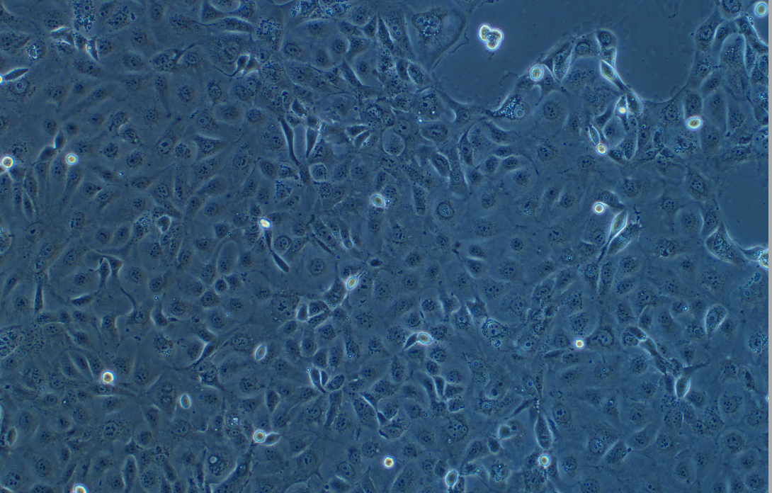 人非小细胞肺癌细胞NCI-H2347(STR鉴定正确)