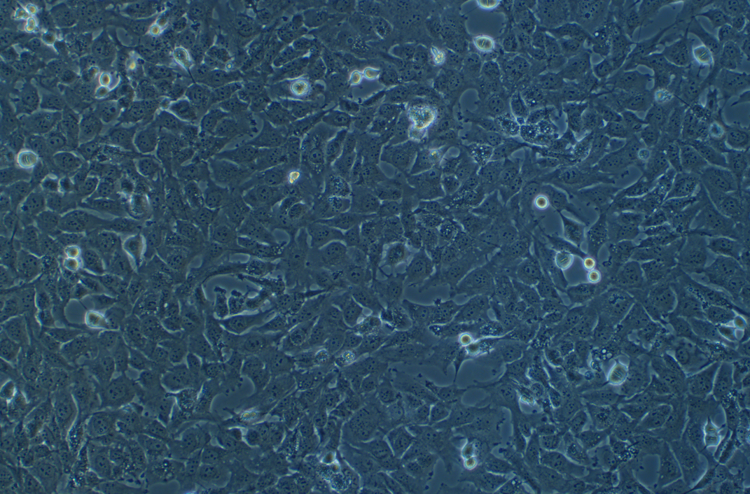 人甲状腺癌细胞KHM-5M(STR鉴定正确)