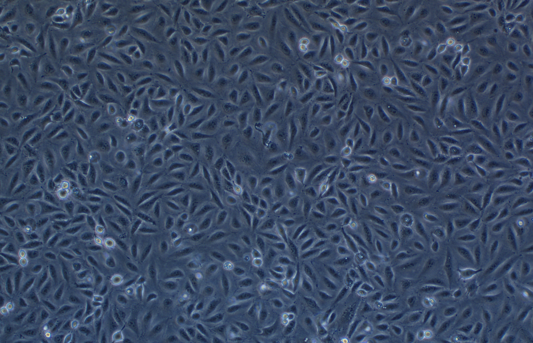 人肺腺癌耐顺铂株A549/DDP(STR鉴定正确)