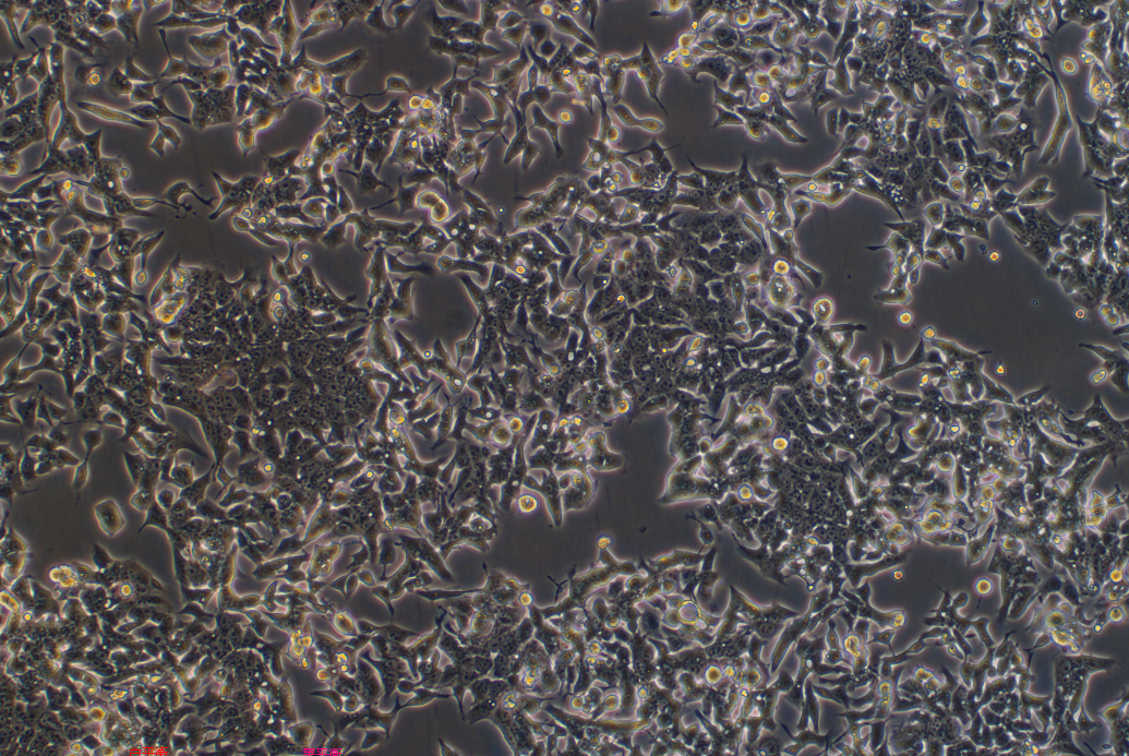 人结直肠癌细胞绿色标记+荧光素酶标记 LOVO+LUC+GFP (STR鉴定正确)