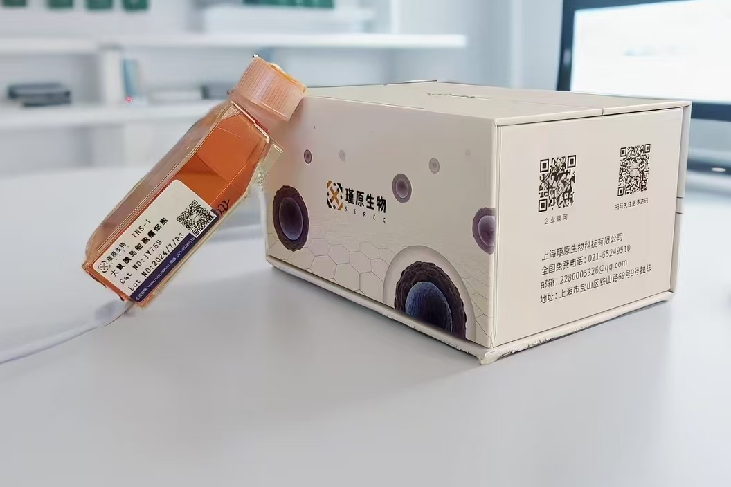 人眼脉络黑色素瘤细胞带红色荧光OCM1A+RFP