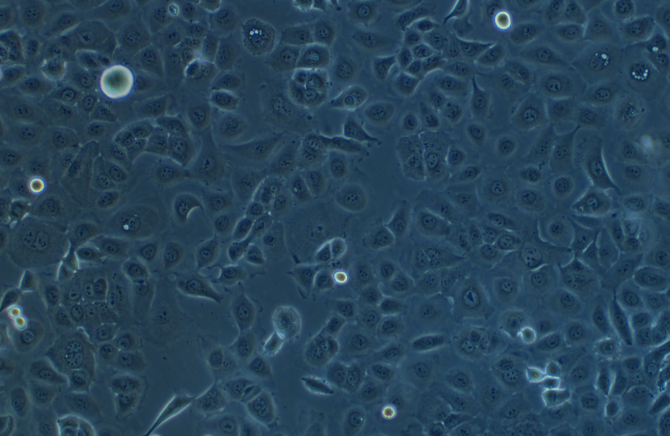 人卵巢癌腺癌细胞带绿色荧光NIH:OVCAR-3+GFP(STR鉴定正确)