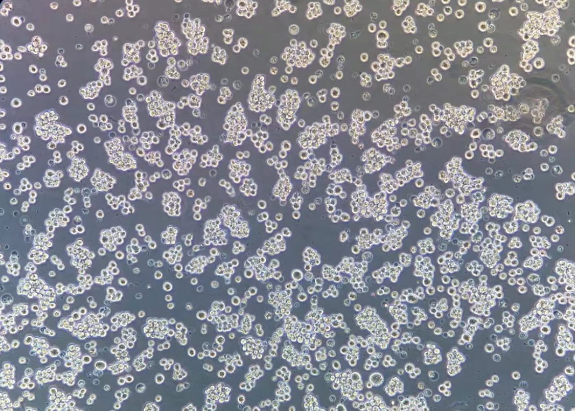 人霍奇金淋巴瘤HDLM-2(STR鉴定正确)