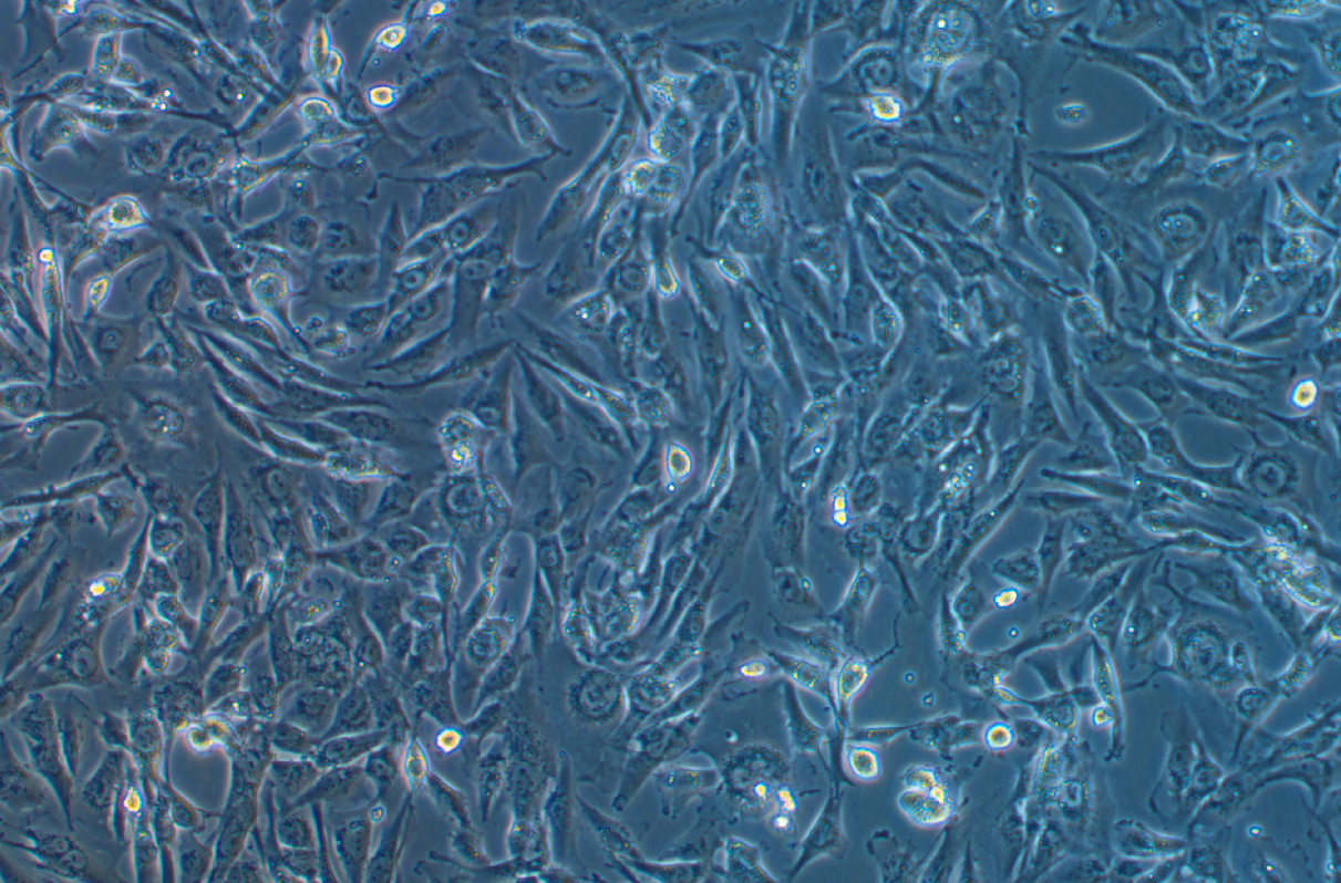 人脑星形胶质细胞瘤细胞SW1088 (STR鉴定正确)