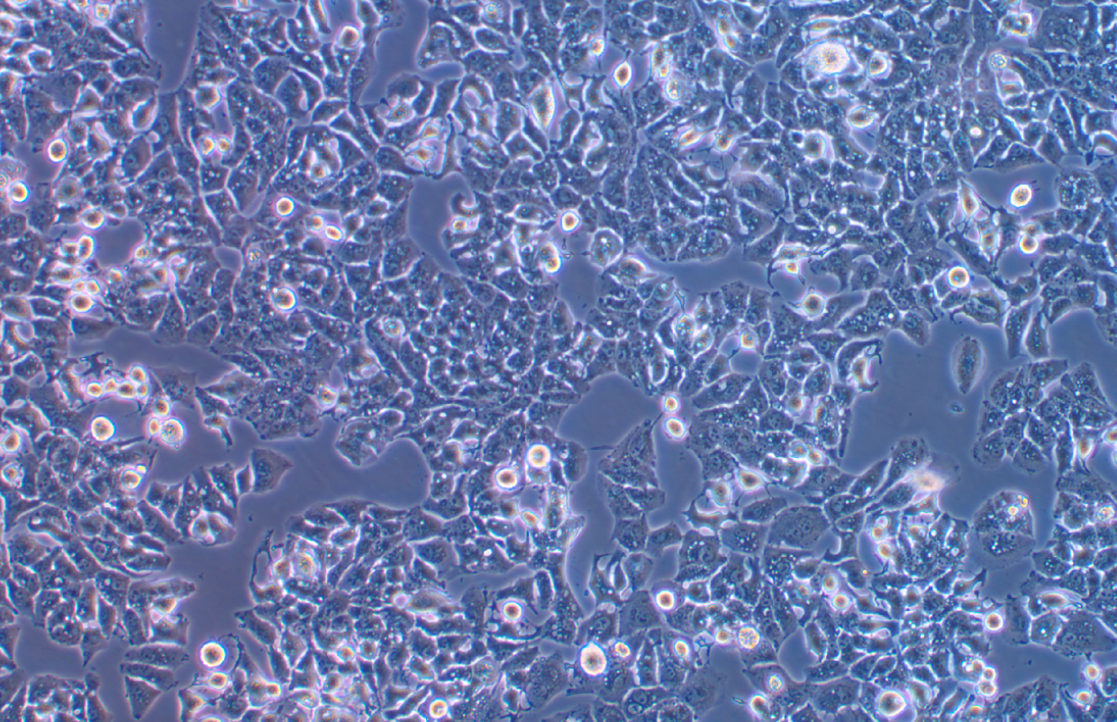 低转移人肝癌细胞带荧光素酶MHCC97-L+LUC(STR鉴定正确)