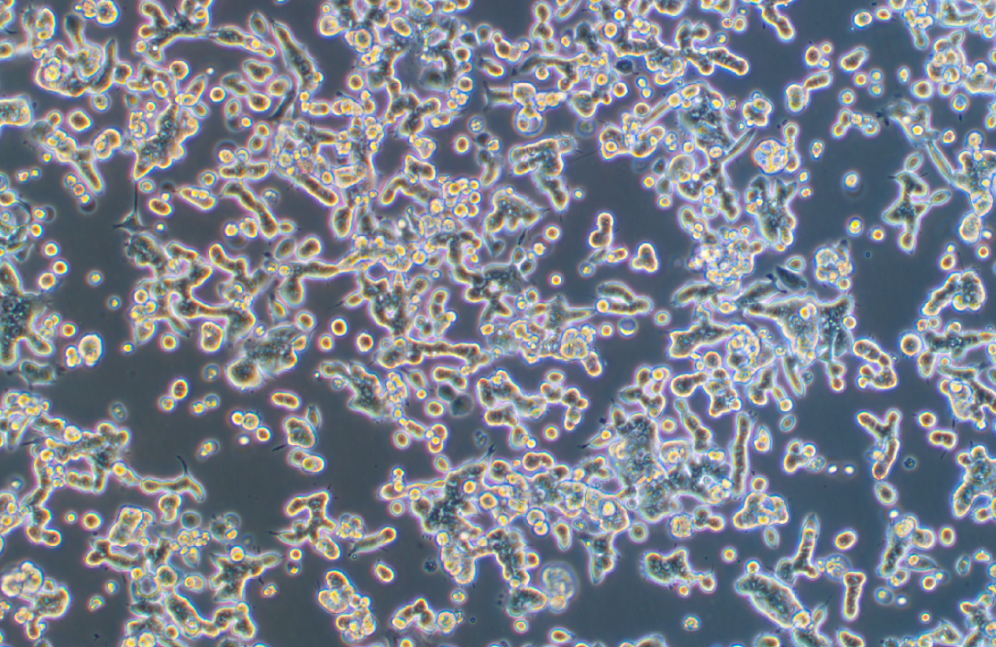 人结肠腺癌细胞SNU-81 (STR鉴定正确)