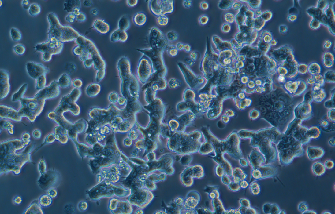 人结肠腺癌细胞SNU-81 (STR鉴定正确)