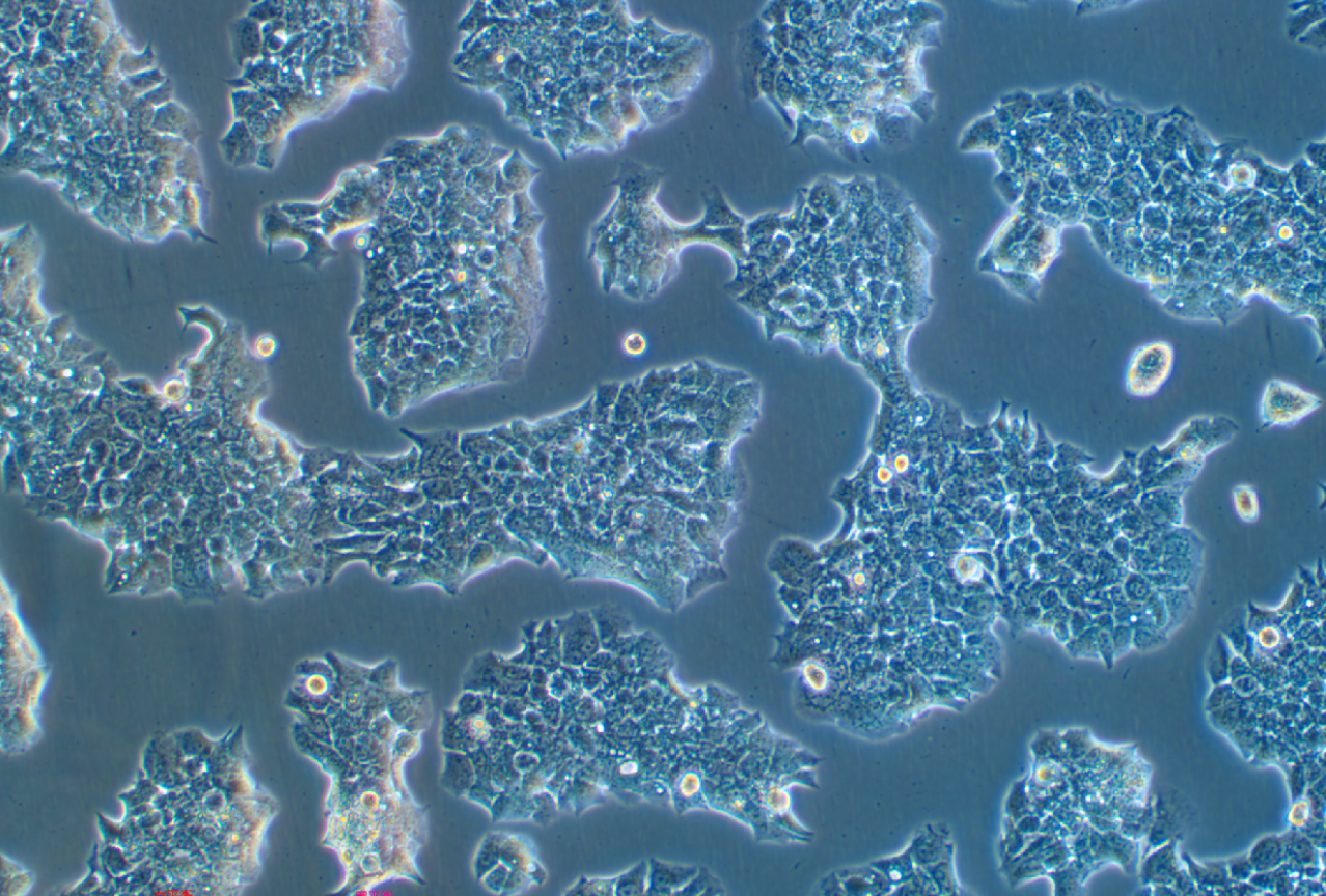 人乳腺导管癌细胞带荧光素酶BT474+LUC (STR鉴定正确)