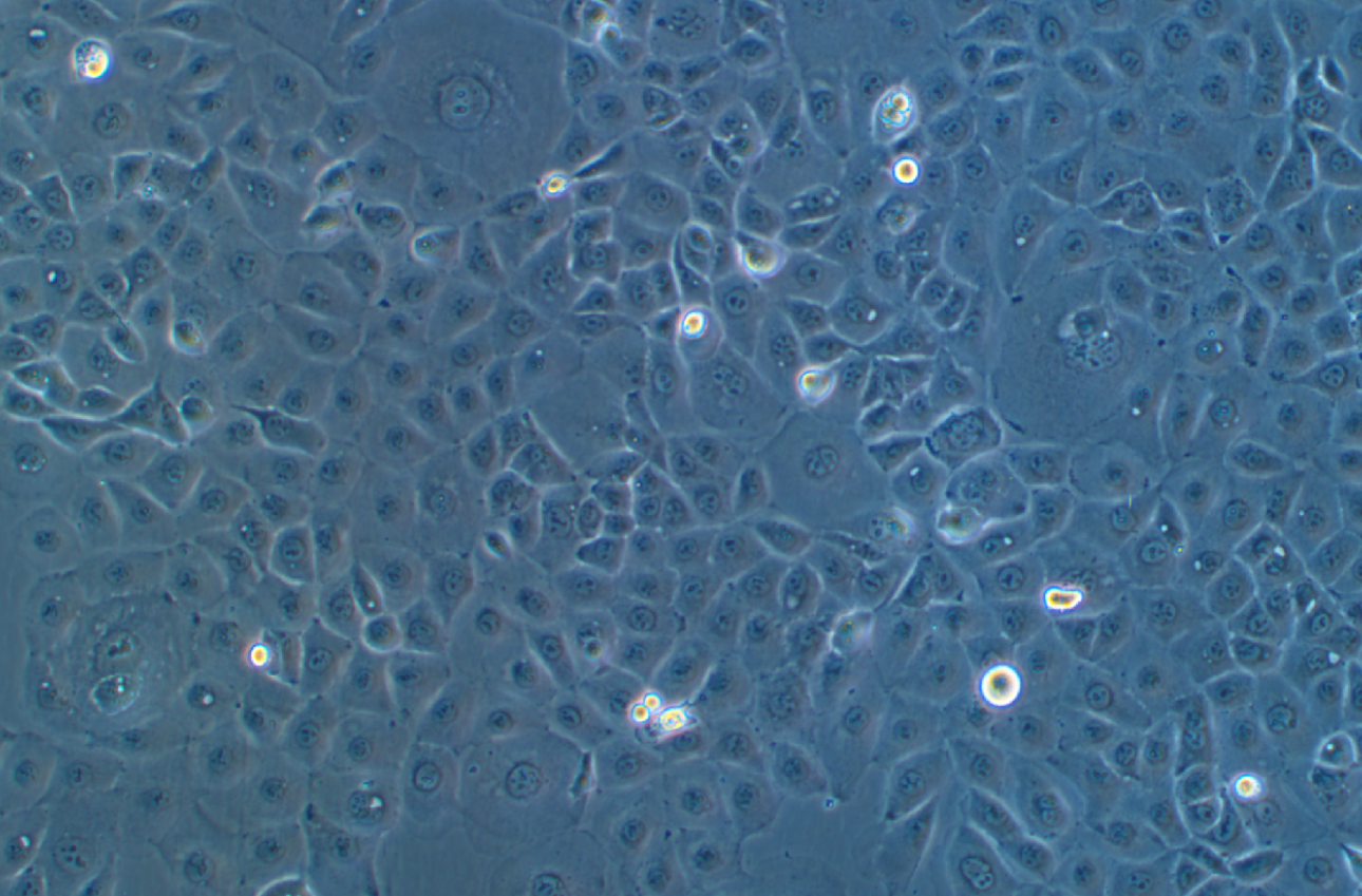 人卵巢癌腺癌细胞带绿色荧光NIH:OVCAR-3+GFP(STR鉴定正确)