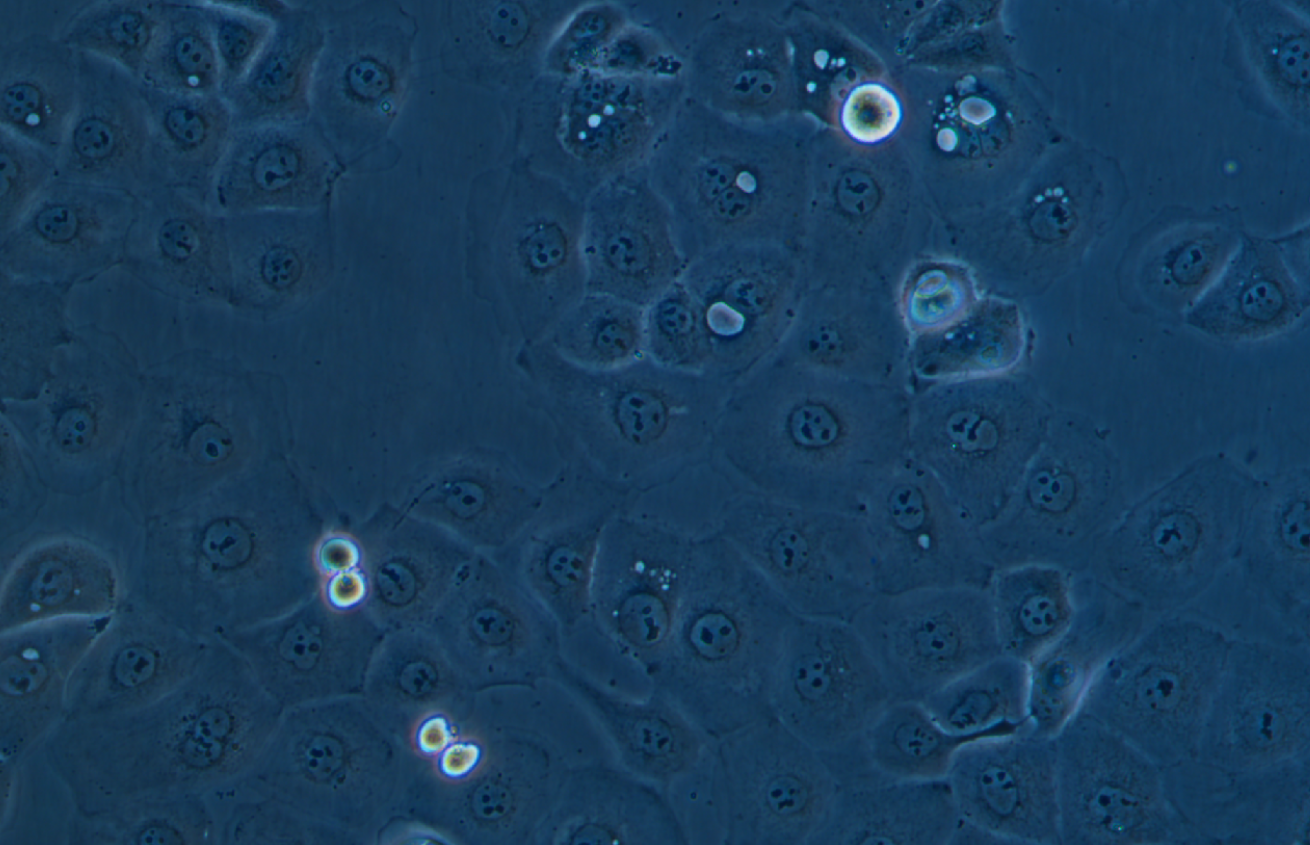 人卵巢癌腺癌细胞带绿色荧光NIH:OVCAR-3+GFP(STR鉴定正确)