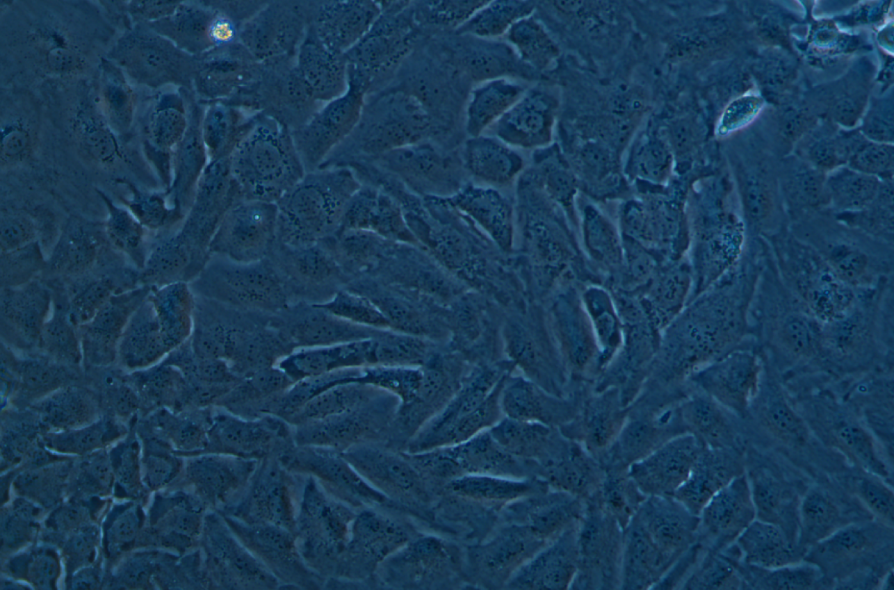 人卵巢癌细胞SKOV3 (STR鉴定正确)