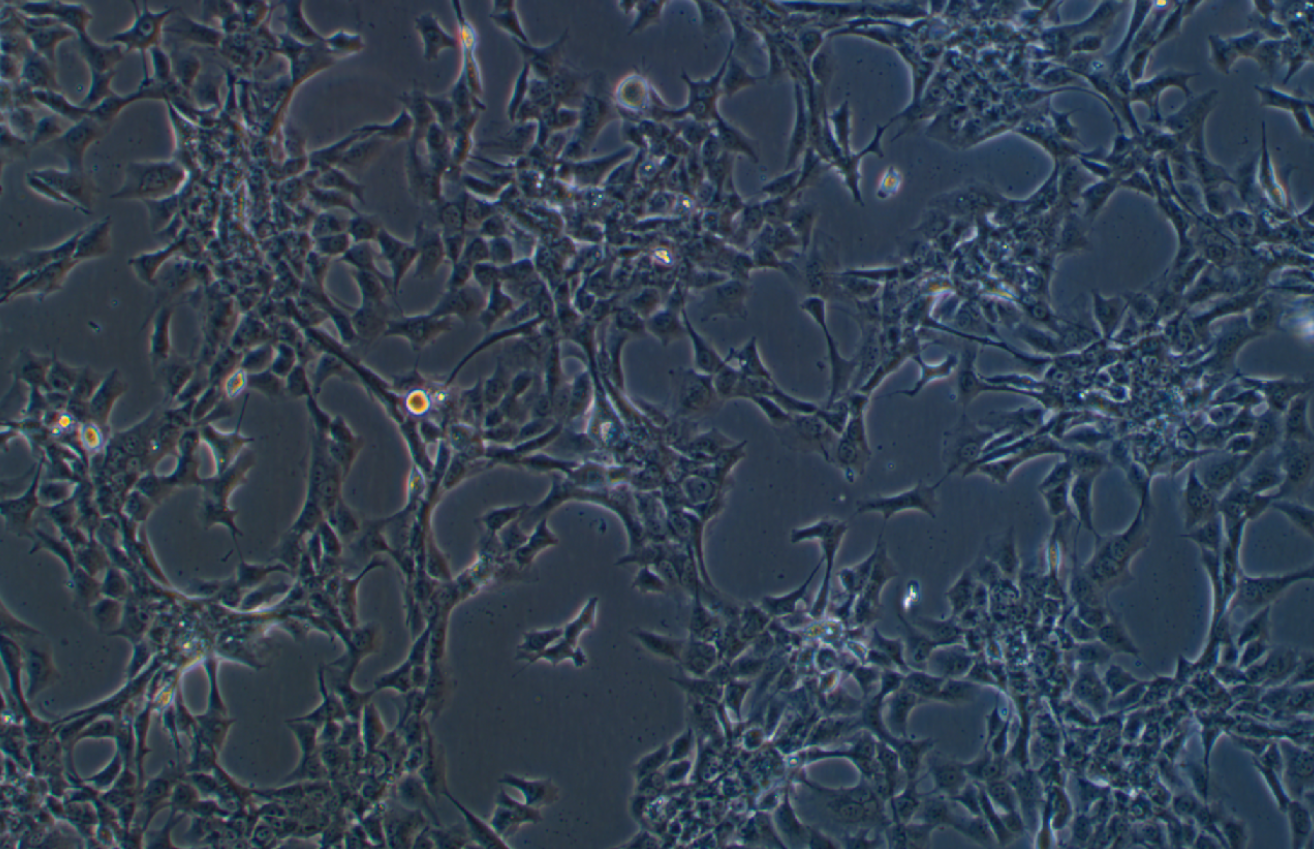 人乳腺癌细胞HCC1395 (STR鉴定正确)