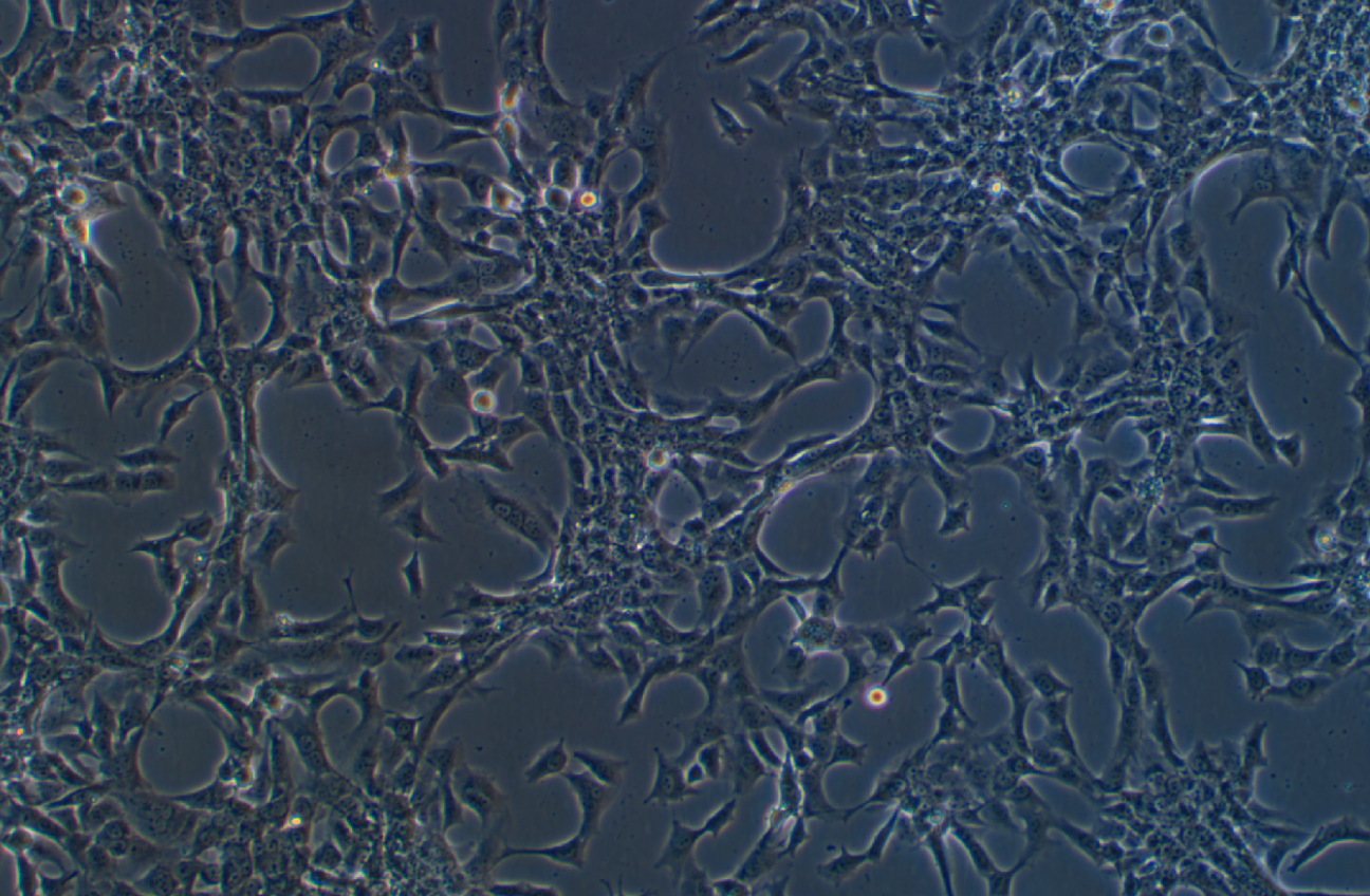 人乳腺癌细胞HCC1395 (STR鉴定正确)