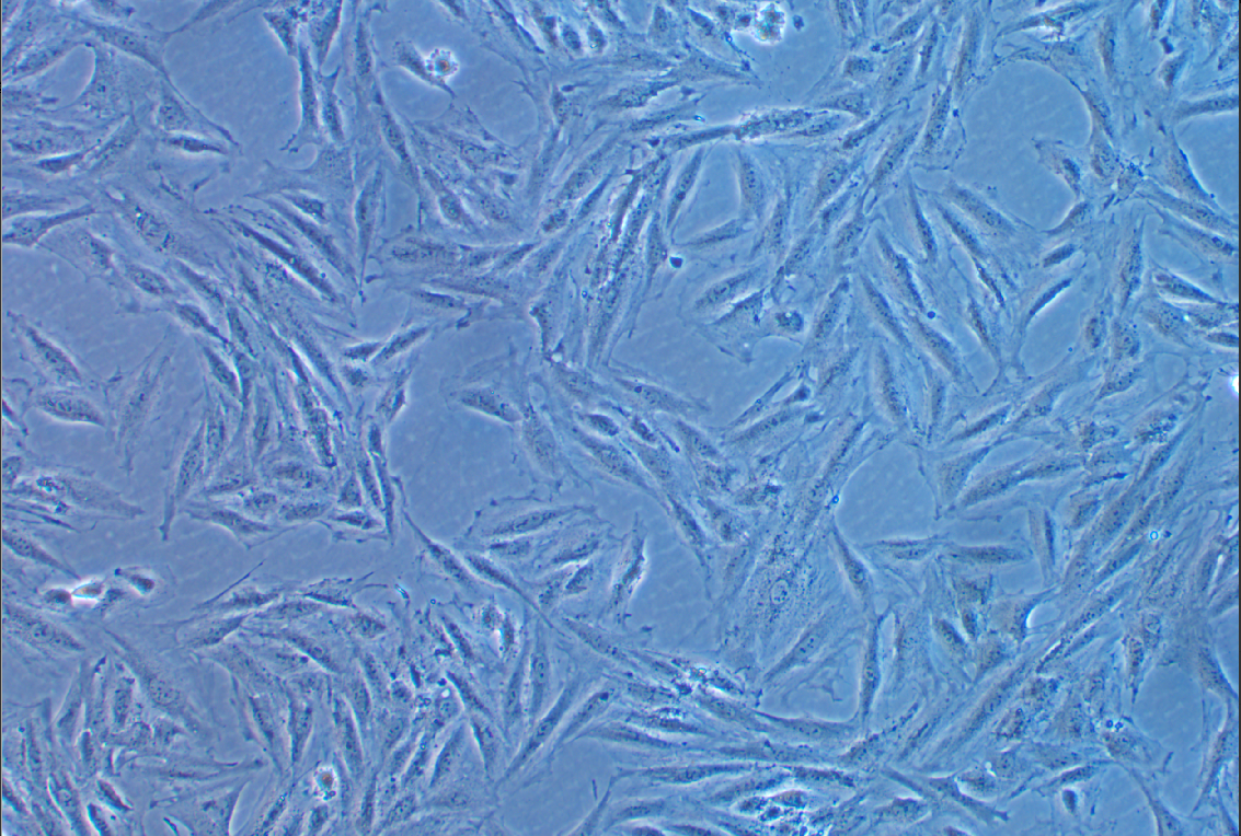 大鼠胚胎心肌细胞H9c2(2-1)+GFP