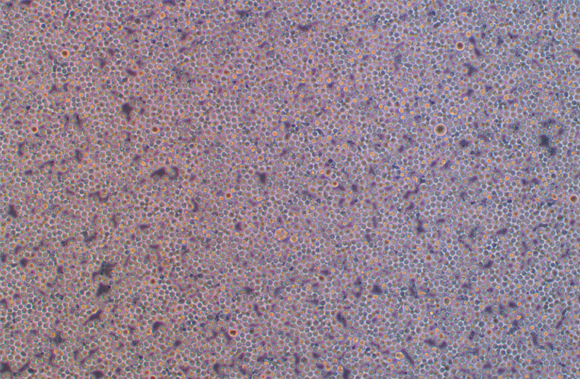 人急性髓系细胞白血病细胞KG-1A(STR鉴定正确)