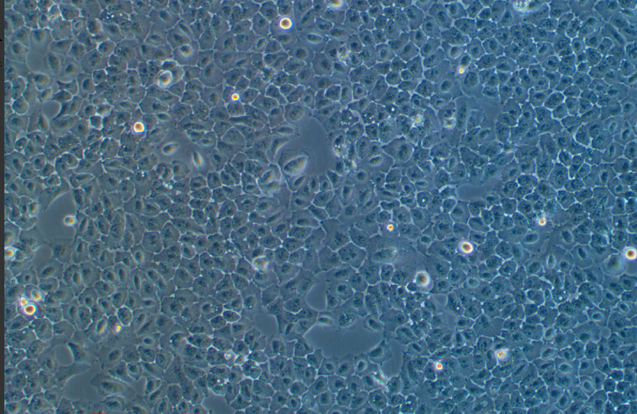 人涎腺腺样囊性癌细胞SACC-83(STR鉴定正确)