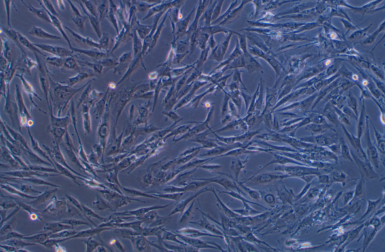 人脑星形胶质细胞瘤细胞SW1088 (STR鉴定正确)