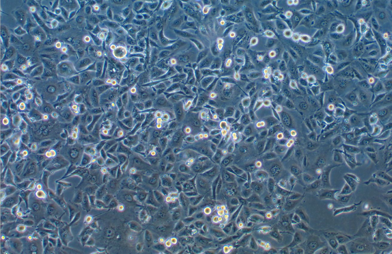 人非小细胞肺癌奥希替尼耐药株HCC-827+Osimertinib (STR鉴定正确)