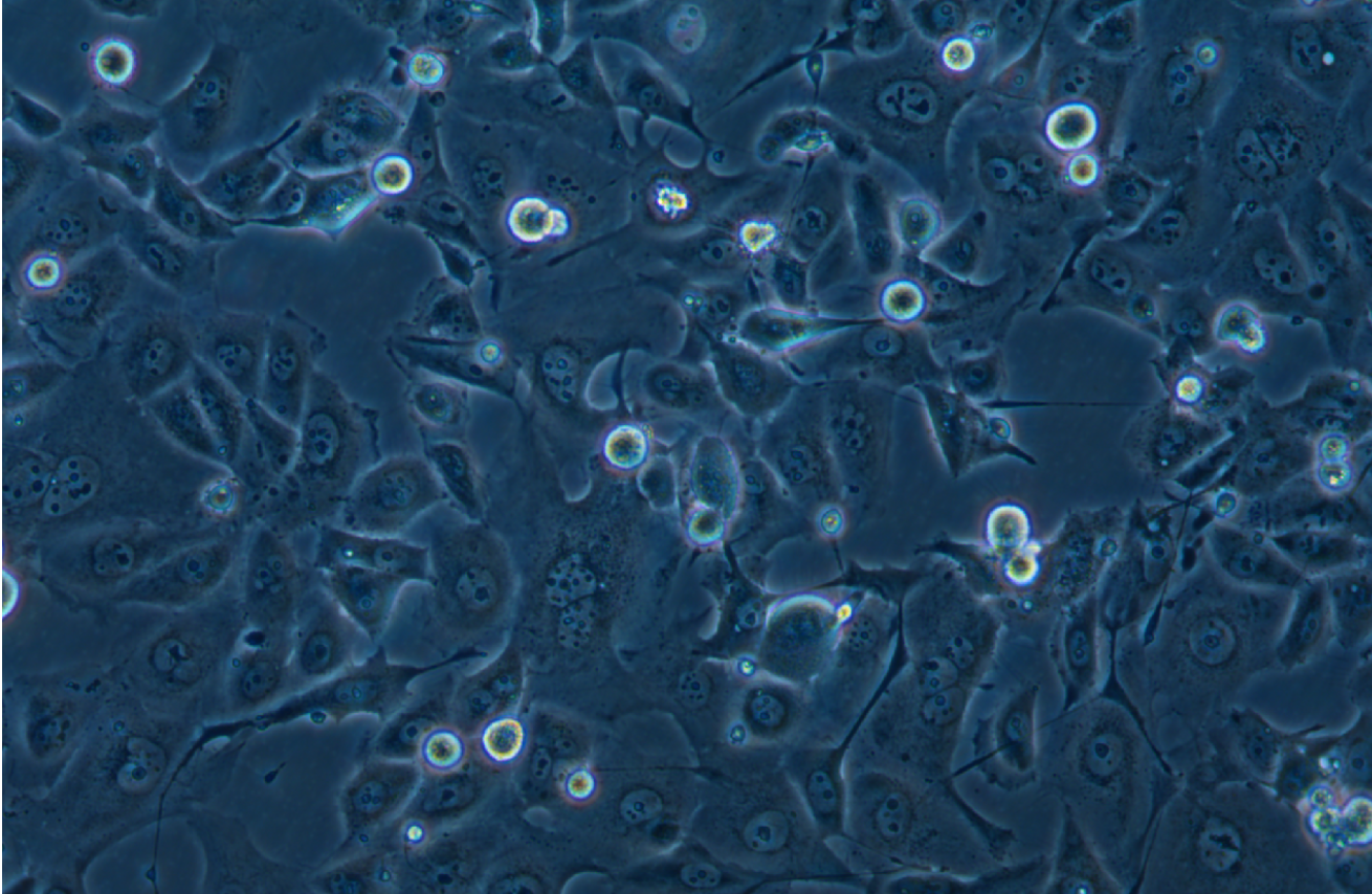 人非小细胞肺癌奥希替尼耐药株HCC-827+Osimertinib (STR鉴定正确)